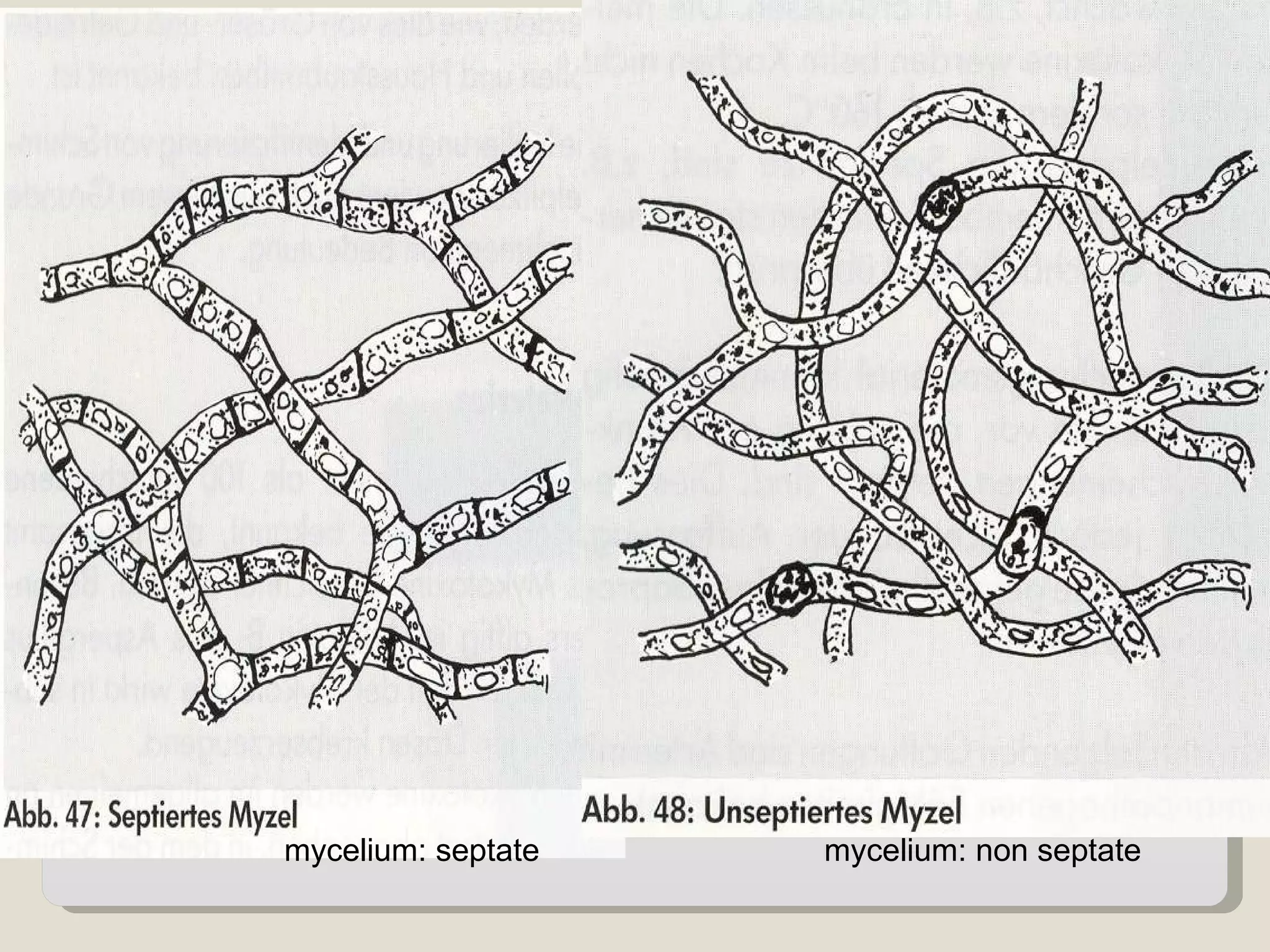 mycelium: septate   mycelium: non septate
 