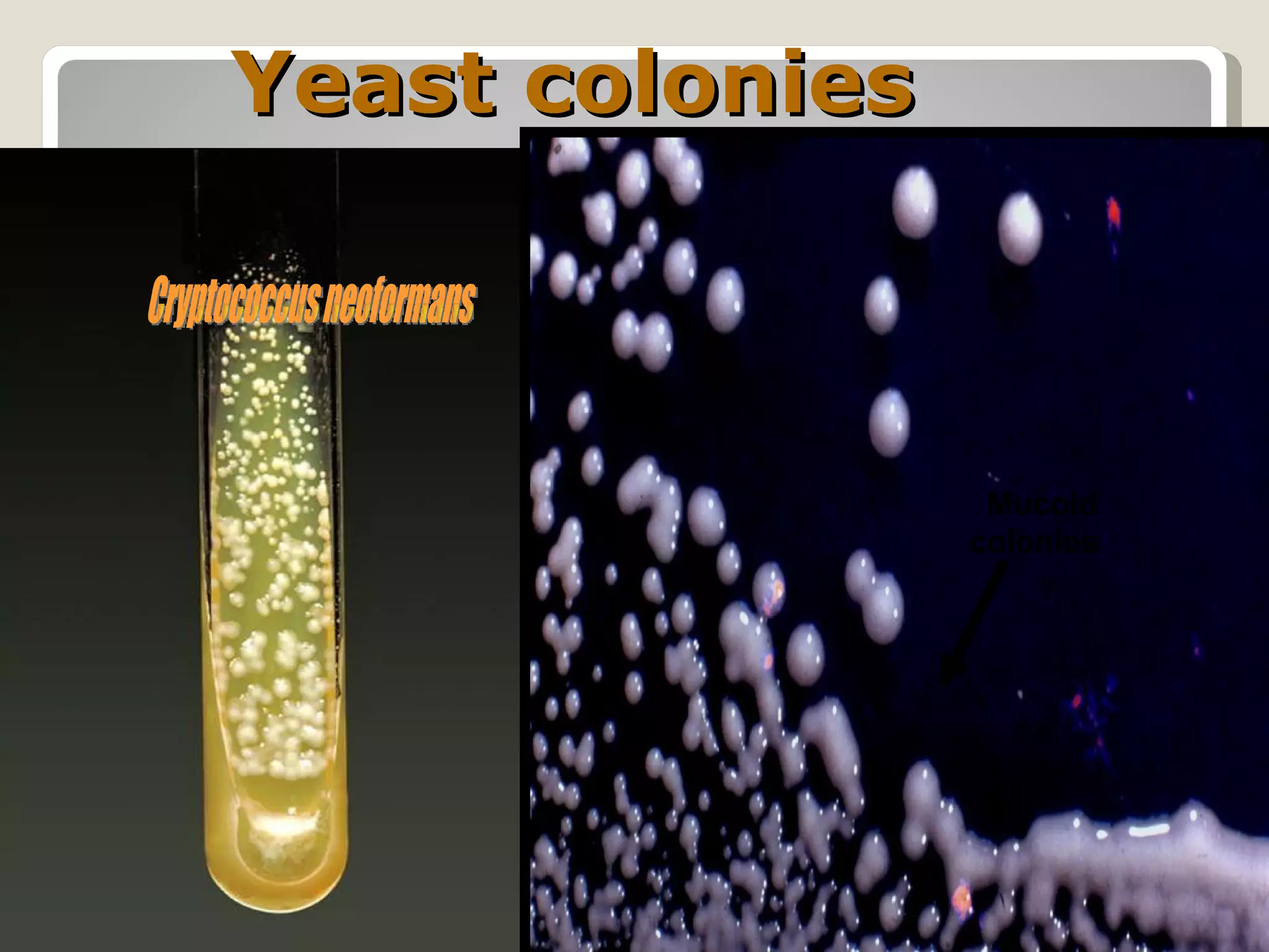 Yeast colonies



                  Mucoid
                 colonies
 
