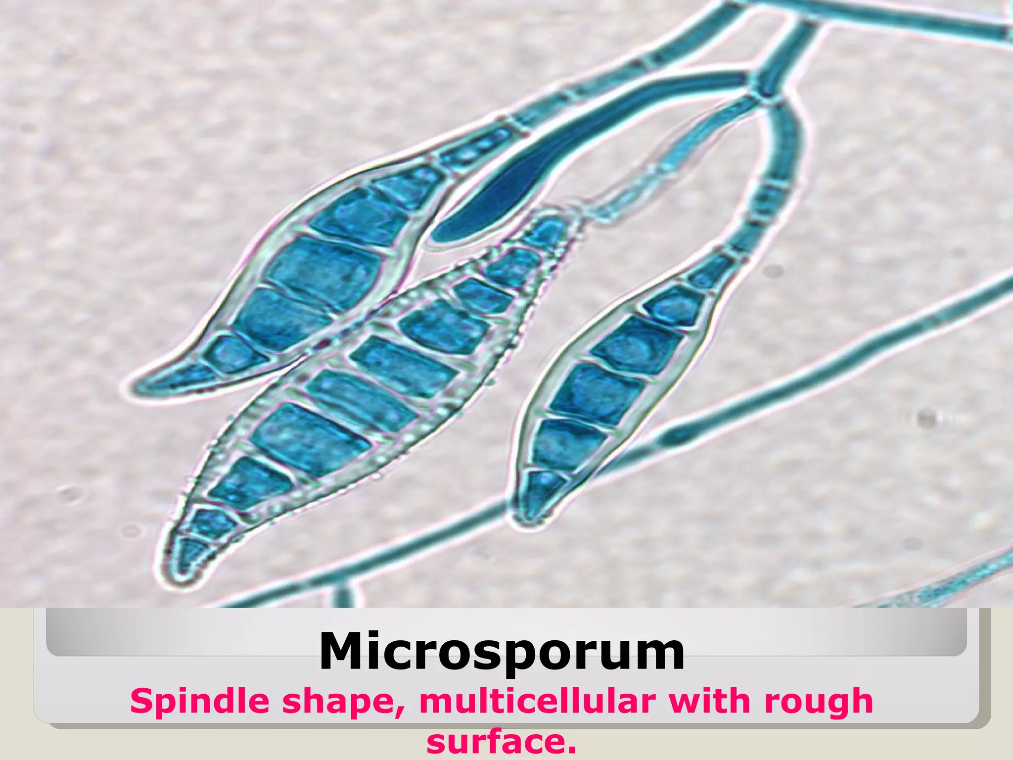 Microsporum
Spindle shape, multicellular with rough
               surface.
 