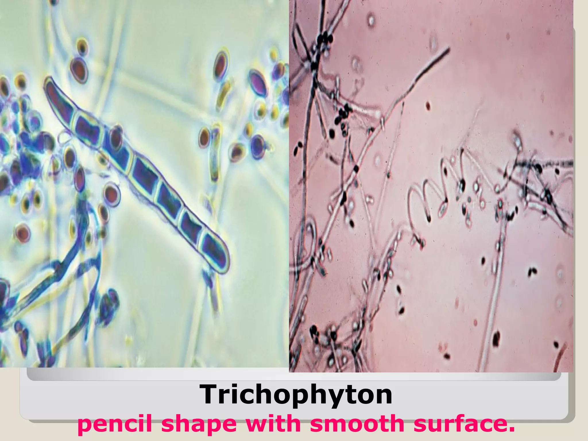 Trichophyton
pencil shape with smooth surface.
 