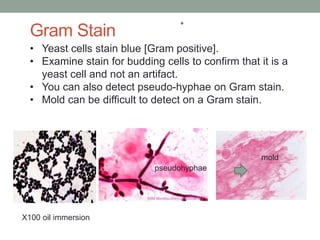 • Yeast cells stain blue [Gram positive].
• Examine stain for budding cells to confirm that it is a
yeast cell and not an artifact.
• You can also detect pseudo-hyphae on Gram stain.
• Mold can be difficult to detect on a Gram stain.
pseudohyphae
mold
pseudohyphae
Gram Stain
X100 oil immersion
 