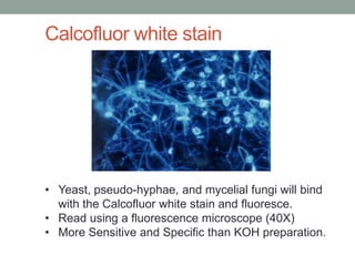 • Yeast, pseudo-hyphae, and mycelial fungi will bind
with the Calcofluor white stain and fluoresce.
• Read using a fluorescence microscope (40X)
• More Sensitive and Specific than KOH preparation.
Calcofluor white stain
 