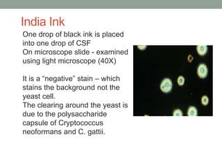 One drop of black ink is placed
into one drop of CSF
On microscope slide - examined
using light microscope (40X)
It is a “negative” stain – which
stains the background not the
yeast cell.
The clearing around the yeast is
due to the polysaccharide
capsule of Cryptococcus
neoformans and C. gattii.
India Ink
 