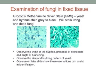 Grocott’s Methenamine Silver Stain [GMS] – yeast
and hyphae stain grey to black. Will stain living
and dead fungi
• Observe the width of the hyphae, presence of septations
and angle of branching.
• Observe the size and budding pattern of yeast.
• Observe on later slides how these oservations can assist
in identification.
Examination of fungi in fixed tissue
 