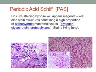Positive staining hyphae will appear magenta – will
also stain structures containing a high proportion
of carbohydrate macromolecules (glycogen,
glycoprotein, proteoglycans) Stains living fungi.
Periodic Acid Schiff [PAS]
 