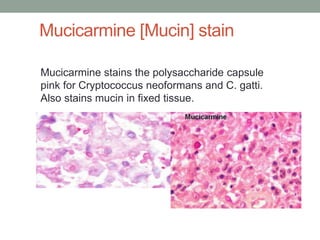 Mucicarmine stains the polysaccharide capsule
pink for Cryptococcus neoformans and C. gatti.
Also stains mucin in fixed tissue.
Mucicarmine [Mucin] stain
 