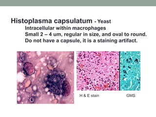 Histoplasma capsulatum - Yeast
Intracellular within macrophages
Small 2 – 4 um, regular in size, and oval to round.
Do not have a capsule, it is a staining artifact.
H & E stain GMS
 