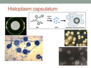 Histoplasm capsulatum
 