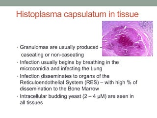 Histoplasma capsulatum in tissue
• Granulomas are usually produced –
caseating or non-caseating
• Infection usually begins by breathing in the
microconidia and infecting the Lung
• Infection disseminates to organs of the
Reticuloendothelial System (RES) – with high % of
dissemination to the Bone Marrow
• Intracellular budding yeast (2 – 4 µM) are seen in
all tissues
 