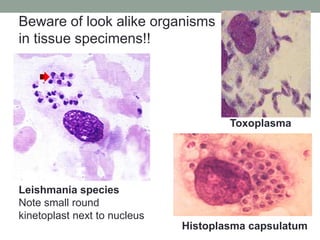 Leishmania species
Note small round
kinetoplast next to nucleus
Toxoplasma
Histoplasma capsulatum
Beware of look alike organisms
in tissue specimens!!
 