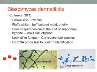 Blastomyces dermatitidis
• Culture at 30˚C
• Grows in 2- 3 weeks
• Fluffy white – buff colored mold, prickly
• Pear shaped conidia at the end of supporting
hyphae – looks like lollipops
• Look alike fungus – Chrysosporium species
• Do DNA probe test to confirm identification
Blastomyces
Chrysosporium
 
