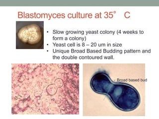 • Slow growing yeast colony (4 weeks to
form a colony)
• Yeast cell is 8 – 20 um in size
• Unique Broad Based Budding pattern and
the double contoured wall.
Blastomyces culture at 35° C
Broad based bud
 