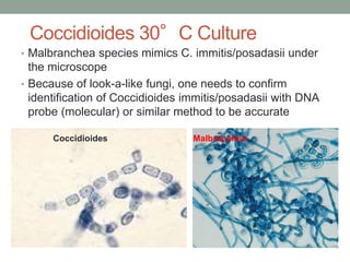 Coccidioides 30°C Culture
• Malbranchea species mimics C. immitis/posadasii under
the microscope
• Because of look-a-like fungi, one needs to confirm
identification of Coccidioides immitis/posadasii with DNA
probe (molecular) or similar method to be accurate
Coccidioides Malbranchea
 