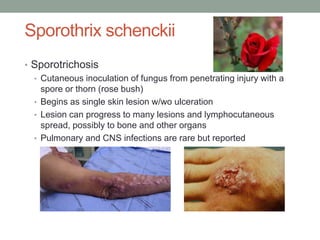 Sporothrix schenckii
• Sporotrichosis
• Cutaneous inoculation of fungus from penetrating injury with a
spore or thorn (rose bush)
• Begins as single skin lesion w/wo ulceration
• Lesion can progress to many lesions and lymphocutaneous
spread, possibly to bone and other organs
• Pulmonary and CNS infections are rare but reported
 