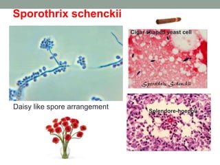 Daisy like spore arrangement
Sporothrix schenckii
Cigar shaped yeast cell
Splendore-hoeppli
 