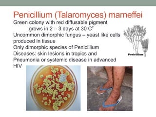 Green colony with red diffusable pigment
grows in 2 – 3 days at 30 C°
Uncommon dimorphic fungus – yeast like cells
produced in tissue
Only dimorphic species of Penicillium
Diseases: skin lesions in tropics and
Pneumonia or systemic disease in advanced
HIV
Penicillium (Talaromyces) marneffei
 