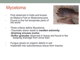 Mycetoma
• First observed in India and known
as Madura Foot or Maduromycosis
• Found in the hot temperate parts of
the world
• Three criteria define Mycetoma:
-Traumatic lesion leads to swollen extremity
-Draining sinuses evolve
-Sulfur granules observed in tissue and found in the
weeping drainage from sinus tract
• Fungus grows on organic debris in soil
• Implanted into subcutaneous tissue from trauma
 