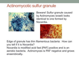 Edge of granule has thin filamentous bacteria: How can
you tell if it is Nocardia?
Nocardia is modified acid fast [PAF] positive and is an
aerobic bacteria. Actinomyces is PAF negative and grows
anaerobically.
Beware! Sulfur granule caused
by Actinomyces israelii looks
identical to one formed by
Nocardia.
Actinomycotic sulfur granule
 