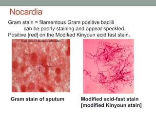 Gram stain = filamentous Gram positive bacilli
can be poorly staining and appear speckled.
Positive [red] on the Modified Kinyoun acid fast stain.
Modified acid-fast stain
[modified Kinyoun stain]
Gram stain of sputum
Nocardia
 