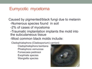 Eumycotic mycetoma
Caused by pigmented/black fungi due to melanin
-Numerous species found in soil
-2% of cases of mycetoma
-Traumatic implantation implants the mold into
the subcutaneous tissue
-Most common black molds include:
Cladophialophora (Cladosporium) carrionii
Cladophialophora bantiana
Phialophora verrucosa
Fonsecaea pedrosoi
Exophiala species
Wangiella species
 