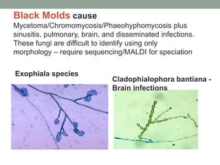 Exophiala species
Black Molds cause
Mycetoma/Chromomycosis/Phaeohyphomycosis plus
sinusitis, pulmonary, brain, and disseminated infections.
These fungi are difficult to identify using only
morphology – require sequencing/MALDI for speciation
Cladophialophora bantiana -
Brain infections
 