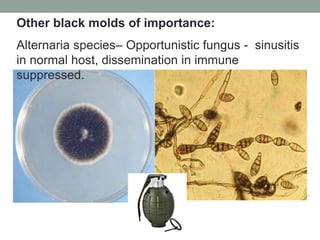 Alternaria species– Opportunistic fungus - sinusitis
in normal host, dissemination in immune
suppressed.
Other black molds of importance:
 