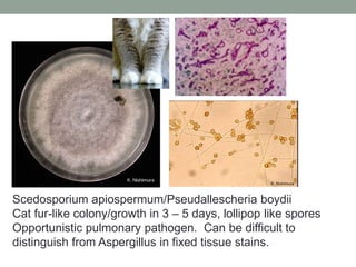 Scedosporium apiospermum/Pseudallescheria boydii
Cat fur-like colony/growth in 3 – 5 days, lollipop like spores
Opportunistic pulmonary pathogen. Can be difficult to
distinguish from Aspergillus in fixed tissue stains.
 