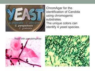 ChromAgar for the
identification of Candida
using chromogenic
substrates.
The unique colors can
identify 4 yeast species.
Yeast with pseudohyphae
 
