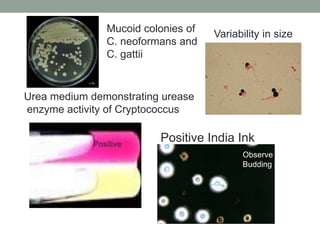 Positive India Ink
Urea medium demonstrating urease
enzyme activity of Cryptococcus
Observe
Budding cells
Variability in size
Positive
Mucoid colonies of
C. neoformans and
C. gattii
 