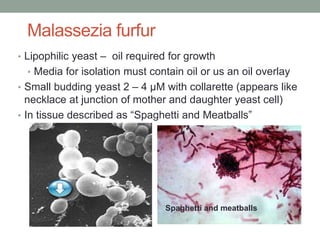 Malassezia furfur
• Lipophilic yeast – oil required for growth
• Media for isolation must contain oil or us an oil overlay
• Small budding yeast 2 – 4 µM with collarette (appears like
necklace at junction of mother and daughter yeast cell)
• In tissue described as “Spaghetti and Meatballs”
Spaghetti and meatballs
 