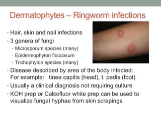 Dermatophytes – Ringworm infections
• Hair, skin and nail infections
• 3 genera of fungi
• Microsporum species (many)
• Epidermophyton floccosum
• Trichophyton species (many)
• Disease described by area of the body infected:
For example: tinea capitis (head), t. pedis (foot)
• Usually a clinical diagnosis not requiring culture
• KOH prep or Calcofluor white prep can be used to
visualize fungal hyphae from skin scrapings
 
