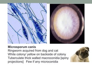 Microsporum canis
Ringworm acquired from dog and cat
White colony/ yellow on backside of colony
Tuberculate thick walled macroconidia [spiny
projections] Few if any microconidia
 