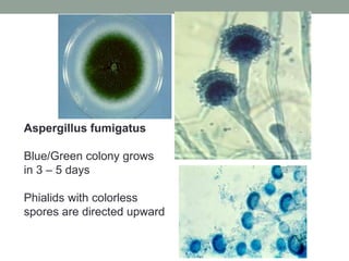 Aspergillus fumigatus
Blue/Green colony grows
in 3 – 5 days
Phialids with colorless
spores are directed upward
 