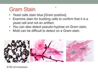 • Yeast cells stain blue [Gram positive].
• Examine stain for budding cells to confirm that it is a
yeast cell and not an ...