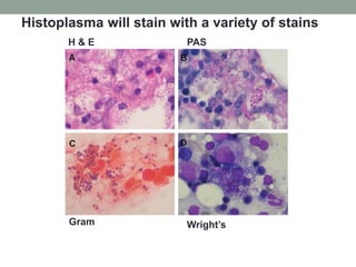 H & E PAS
Gram Wright’s
Histoplasma will stain with a variety of stains
 
