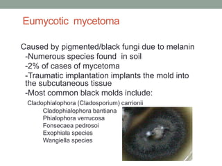 Eumycotic mycetoma
Caused by pigmented/black fungi due to melanin
-Numerous species found in soil
-2% of cases of mycetoma...