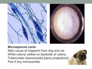 Microsporum canis
Main cause of ringworm from dog and cat
White colony/ yellow on backside of colony
Tuberculate macroconidia [spiny projections]
Few if any microconidia
 