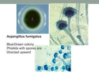 Aspergillus fumigatus
Blue/Green colony
Phialids with spores are
Directed upward
 