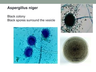 Aspergillus niger
Black colony
Black spores surround the vesicle
 