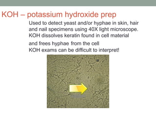 Used to detect yeast and/or hyphae in skin, hair
and nail specimens using 40X light microscope.
KOH dissolves keratin found in cell material
and frees hyphae from the cell
KOH exams can be difficult to interpret!
KOH – potassium hydroxide prep
 