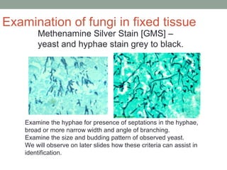 Methenamine Silver Stain [GMS] –
yeast and hyphae stain grey to black.
Examine the hyphae for presence of septations in the hyphae,
broad or more narrow width and angle of branching.
Examine the size and budding pattern of observed yeast.
We will observe on later slides how these criteria can assist in
identification.
Examination of fungi in fixed tissue
 