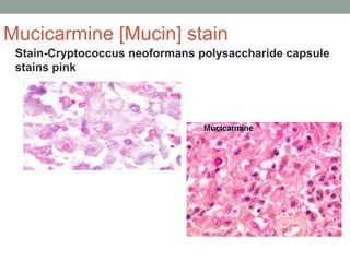 Stain-Cryptococcus neoformans polysaccharide capsule
stains pink
Mucicarmine [Mucin] stain
 