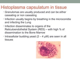 Histoplasma capsulatum in tissue
• Granulomas are usually produced and can be either
caseating or non caseating
• Infection usually begins by breathing in the microconidia
and infecting the Lung
• Infection disseminates to organs of the
Reticuloendothelial System (RES) – with high % of
dissemination to the Bone Marrow
• Intracellular budding yeast (2 – 4 µM) are seen in all
tissues
 