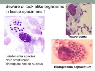 Leishmania species
Note small round
kinetoplast next to nucleus
Toxoplasma
Histoplasma capsulatum
Beware of look alike org...