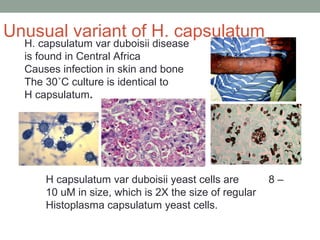 H capsulatum var duboisii yeast cells are 8 –
10 uM in size, which is 2X the size of regular
Histoplasma capsulatum yeast ...