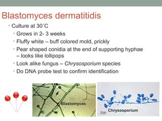 Blastomyces dermatitidis
• Culture at 30˚C
• Grows in 2- 3 weeks
• Fluffy white – buff colored mold, prickly
• Pear shaped...