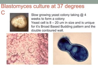 Slow growing yeast colony taking @ 4
weeks to form a colony
Yeast cell is 8 – 20 um in size and is unique
for it’s Broad B...