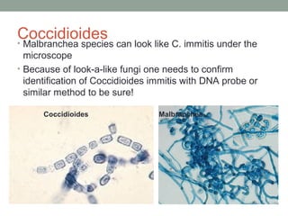 Coccidioides• Malbranchea species can look like C. immitis under the
microscope
• Because of look-a-like fungi one needs to confirm
identification of Coccidioides immitis with DNA probe or
similar method to be sure!
Coccidioides Malbranchea
 
