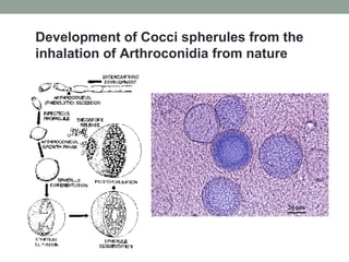 Development of Cocci spherules from the
inhalation of Arthroconidia from nature
 