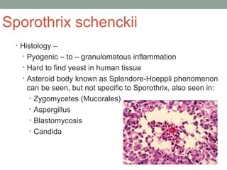 Sporothrix schenckii
• Histology –
• Pyogenic – to – granulomatous inflammation
• Hard to find yeast in human tissue
• Asteroid body known as Splendore-Hoeppli phenomenon
can be seen, but not specific to Sporothrix, also seen in:
• Zygomycetes (Mucorales)
• Aspergillus
• Blastomycosis
• Candida
 